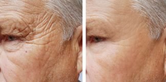 What is Collagen and Why Your Body Needs It